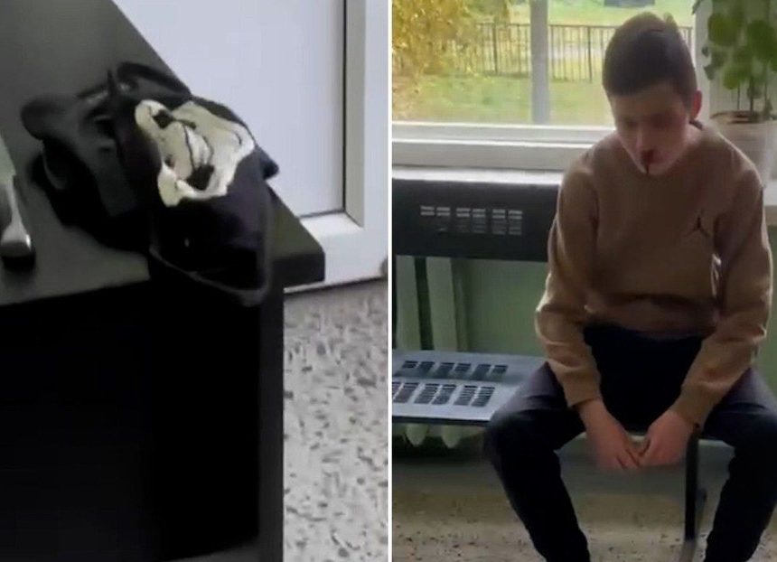 JOVEN ATACA CON CUCHILLO A PROFESORES EN CENTRO TÉCNICO DE RUSIA