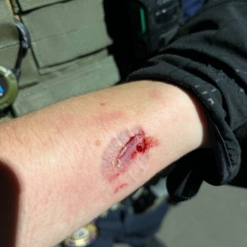 DEPARTAMENTO DE JUSTICIA DE EE.UU PRESENTÓ CARGOS CONTRA MANIFESTANTE ACUSADO DE AGREDIR A AGENTES DE ICE EN NUEVA JERSEY