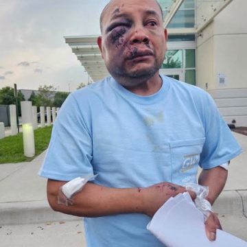 INMIGRANTE DENUNCIA LESIONES CEREBRALES TRAS OPERATIVO DE ICE